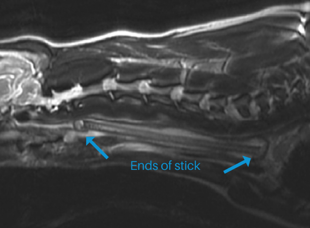 brennan mri