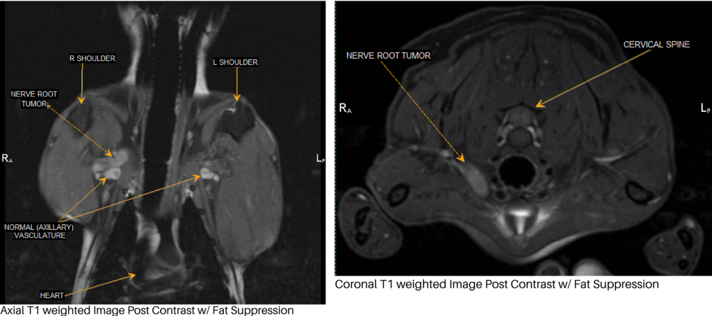 missey mri combined